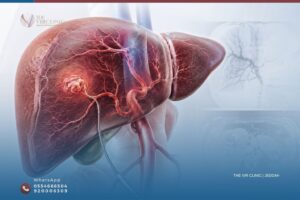 Read more about the article الأعراض المبكرة لأورام الكبد السرطانية: العلامات التي لا يجب تجاهلها