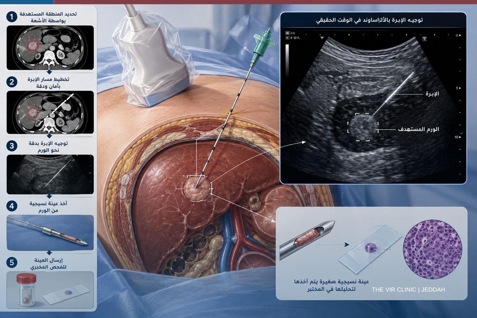 Read more about the article خطوات أخذ الخزعة بالأشعة التداخلية: ماذا يحدث فعليًا؟