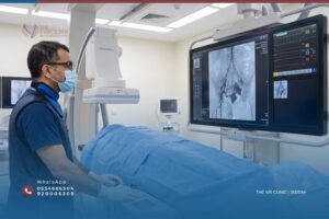 Read more about the article علاج احتقان أوردة الحوض بدون جراحة في جدة